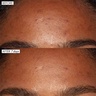 Sunday Riley Good Genes Lactic Acid Treatment 50ml
